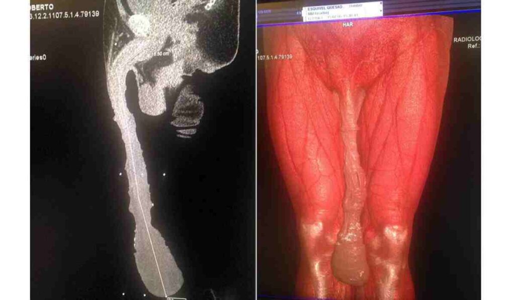 Roberto Esquivel Cabrera penis x-ray